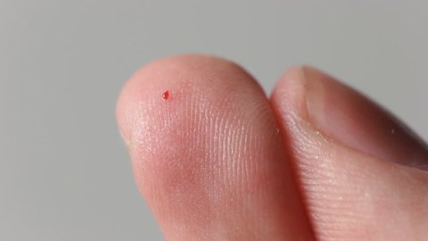 Squeeze out a blood drop from a finger Stock Video