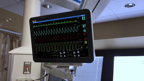 A fictional hospital medical computer scanner screen monitoring a patient's heart. Loopable. Screen created in After Effects.  