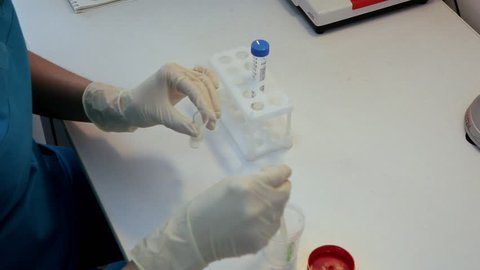 A doctor prepares a semen sample