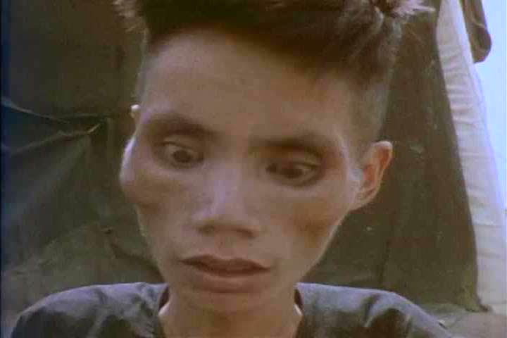 1960s: Prisoners of war are rescued from a North Vietnamese camp and they are starved and injured, during the Vietnam War, in the 1960s.