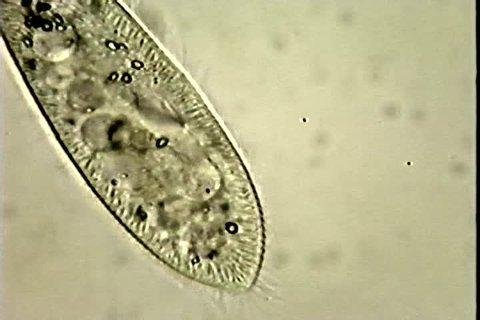 Microscopic scientific: Rare footage:ciliary motion & food vacuole filling at end of gullet of Paramecium.  Then the vacuole can be seen detaching & another begins fill.