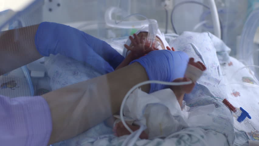 Premature baby in a bed incubator under the supervision of doctors Royalty-Free Stock Footage #27912328