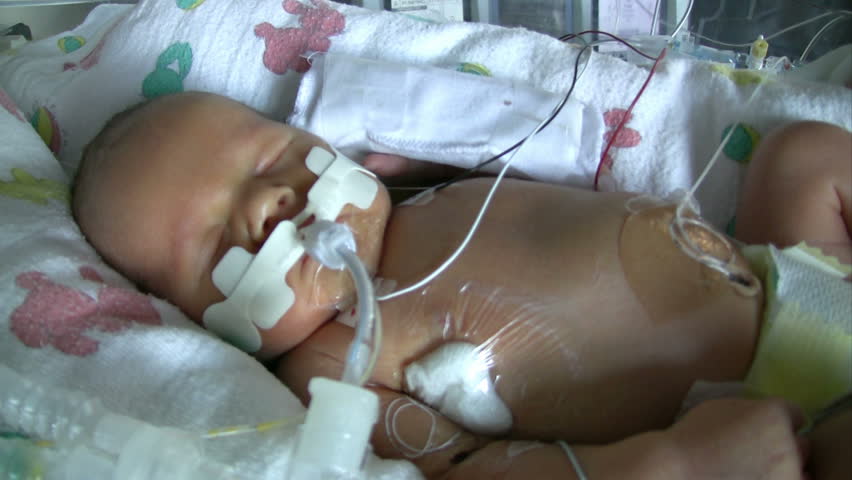 newborn baby nicu