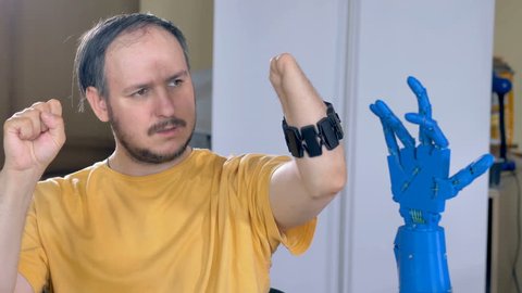 Man with the amputated hand controls robotic hand. 4K.