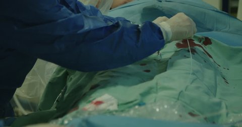 Surgeons preforming a cardiac catheterization in a hospital