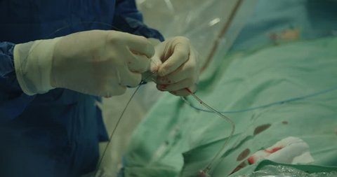 Surgeons preforming a cardiac catheterization in a hospital