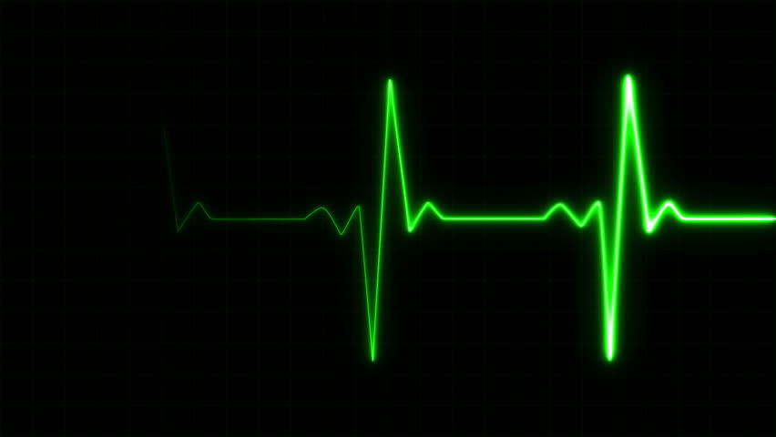 Heart beat pulse in green Royalty-Free Stock Footage #28682146