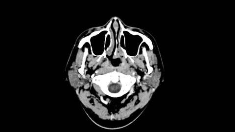 ct scan of upper brain of head top view smooth motion