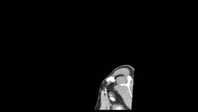 ct scan of neck side view