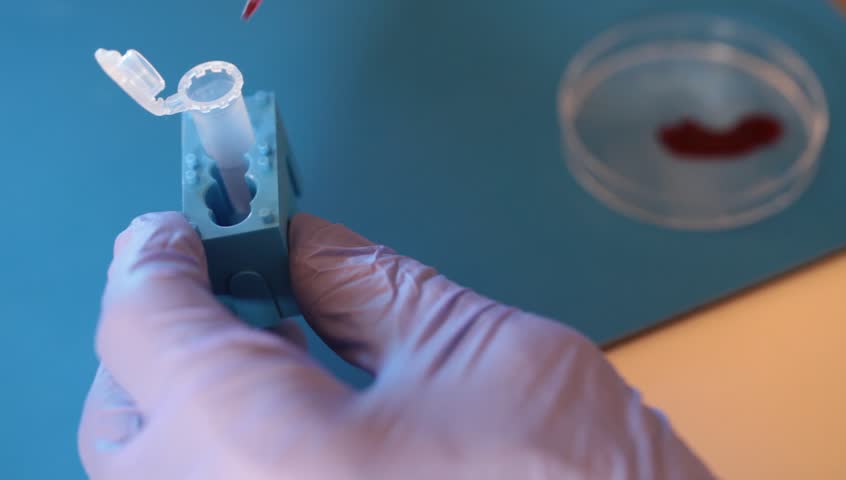 Laboratory pipette filled microtube