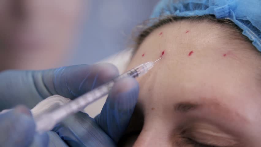 Mitos dan Fakta tentang Botox untuk Keriput