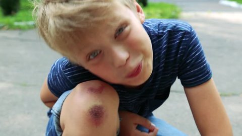 Closeup of injured young kid's knee after he fell down on pavement. Boy poses for camera showing wounded scraped leg. Real time full hd video footage.