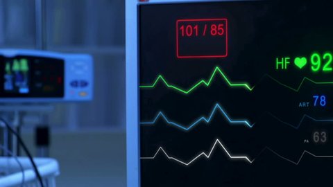 Cinemagraph of pulse checking E.C.G Monitor. Monitor that shows heartbeat activity. Cold atmosphere.
