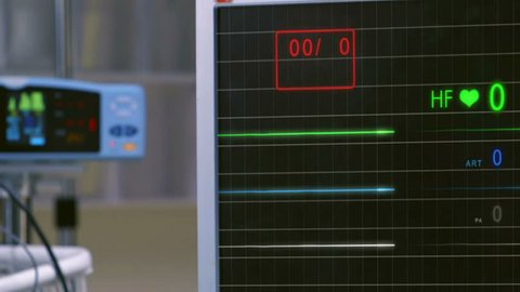 Cinemagraph of pulse checking E.C.G Monitor. Monitor that shows a lack of palpitations.