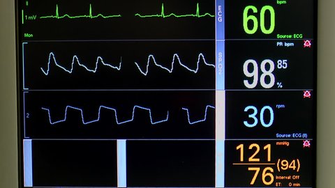 Patient Screening Checkup Displays Ecg の動画素材 ロイヤリティフリー Shutterstock