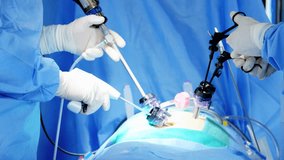 Laparoscopy surgical medical training operation transmitted on hospital monitor performed by Caucasian male wearing surgical gloves and scrubs RED DRAGON