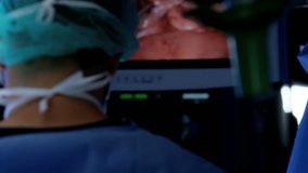 Professional hospital specialist team in scrubs in the operating theatre performing Laparoscopy surgery using video monitor playback and Endoscope and Laparoscope instruments RED DRAGON