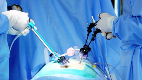 Reveal Laparoscopic Surgical Operation Transmitted On Stock Footage ...