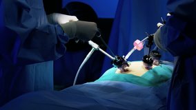 Laparoscopic surgical operation in hospital theatre using Endoscopy and Laparoscopy to specialise in Laparoscopic surgery via video playback camera RED DRAGON