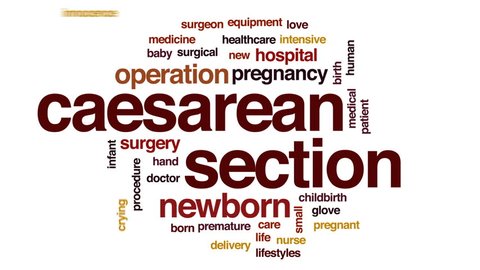 Caesarean section animated word cloud, text design animation.