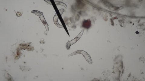 demodex  parasite under skin of dog take video from microscope