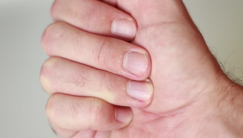 Green pills in male palm