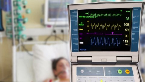 ICU patient with ECG monitor and intraaortic balloon counterpulsation
