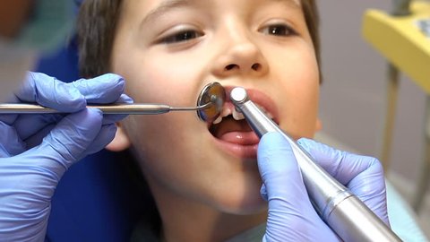 Closeup little kid during procedure of teeth drilling treatment at dentist clinic office. No pain. Smiling. Health
