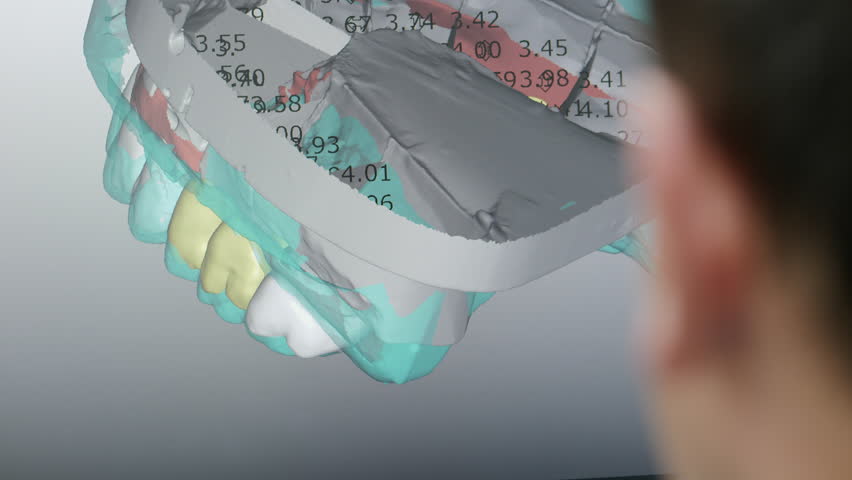 A man creates on the computer a model of the future prosthesis of teeth made on automatic process dental milling machine. Royalty-Free Stock Footage #30791050