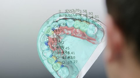 A man creates on the computer a model of the future prosthesis of teeth made on automatic process dental milling machine.