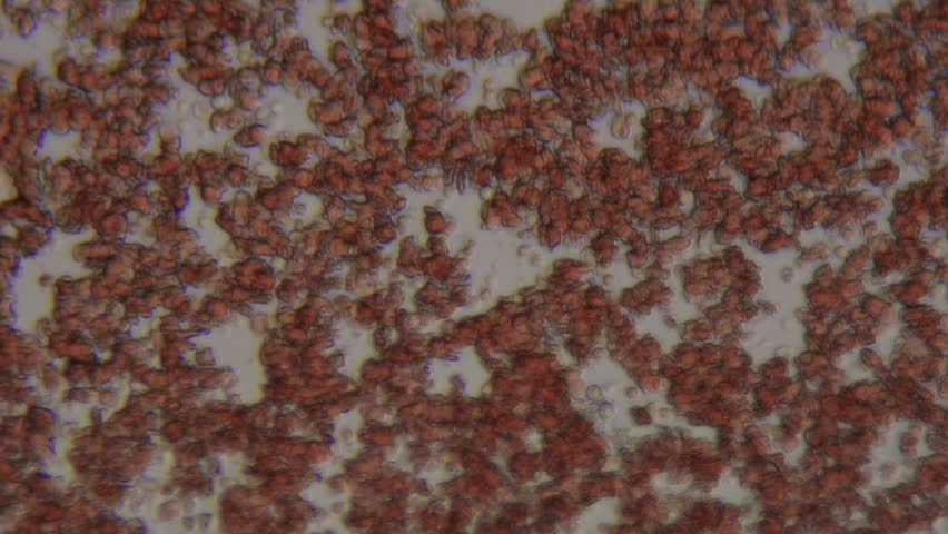 Microscopic macro shot of fresh blood flowing on a slide, light smear, with