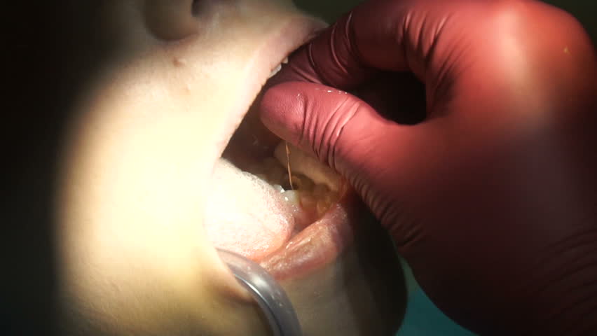 pretty woman treats teeth from dentist