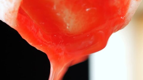 Removal Of Endometrial Tissue の動画素材 ロイヤリティフリー Shutterstock
