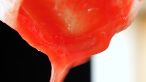 Removal Of Endometrial Tissue の動画素材 ロイヤリティフリー Shutterstock Removal Of Endometrial Tissue の動画素材 ロイヤリティフリー Shutterstock