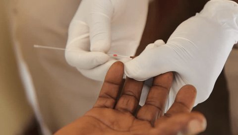 Uganda. 25 April 2017. A healthcare worker pricking a finger for blood testing for HIV positivity.