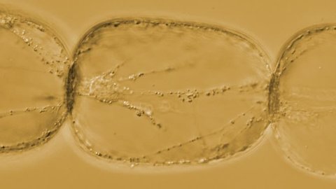 Movement of organelles in Tradescantia stamen hair cells