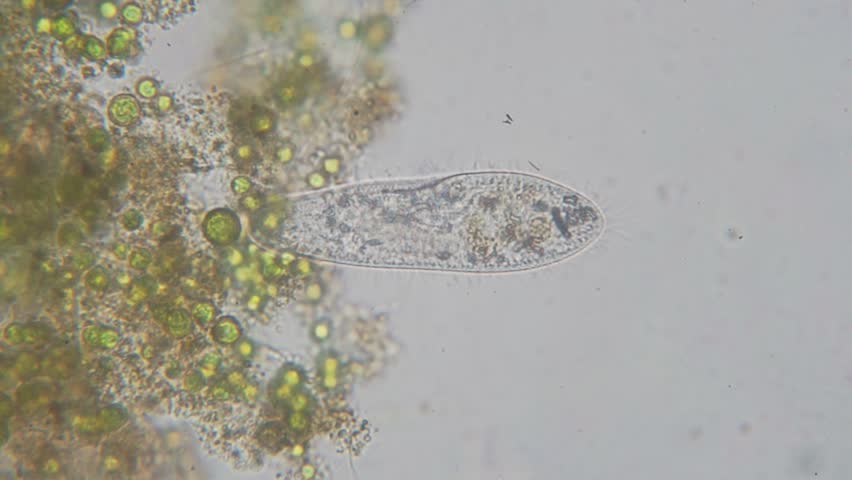 Paramecium Caudatum Is A Genus Stock Footage Video 100 Royalty Free 31781953 Shutterstock