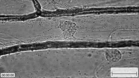 Cytoplasmic streaming (movement of organelles) in onion bulb scale epidermis cells
