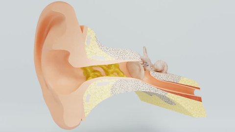 Ear wax swells at high humidity. Temporary hearing loss after taking bath. Model of the inner ear.