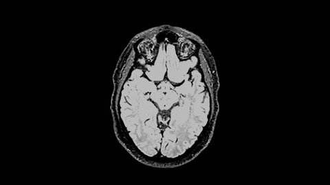 MRI brain scan,magnetic resonance imaging of a brain, ultra hd 4k, time lapse
