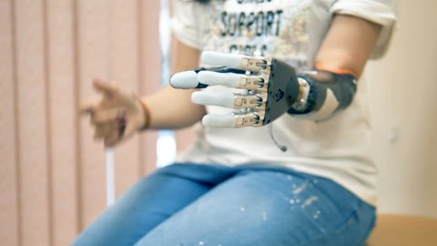 An amputee woman demonstrates her bionic hand. 4K.