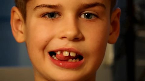 Cute boy showing loose tooth
