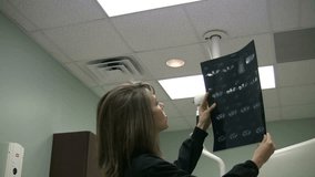 Female doctor looking at x-rays in hospital. Young doctor looking at test results from diagnostic Cat Scan. Pretty doctor looking at anatomy on film from MRI scan.  - Powered by Shutterstock - Get 15% off with code: PIKWIZARD15