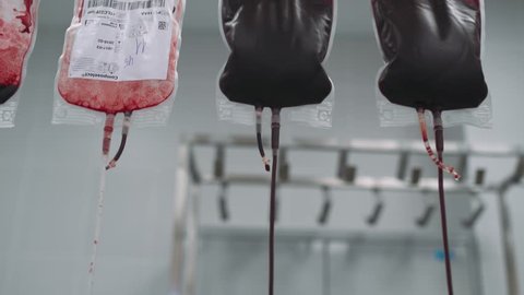 BELARUS, MINSK - NOVEMBER 15, 2017: Hospital, blood in packages, process of purification and filtration of donor blood, November 15 in Belarus.

