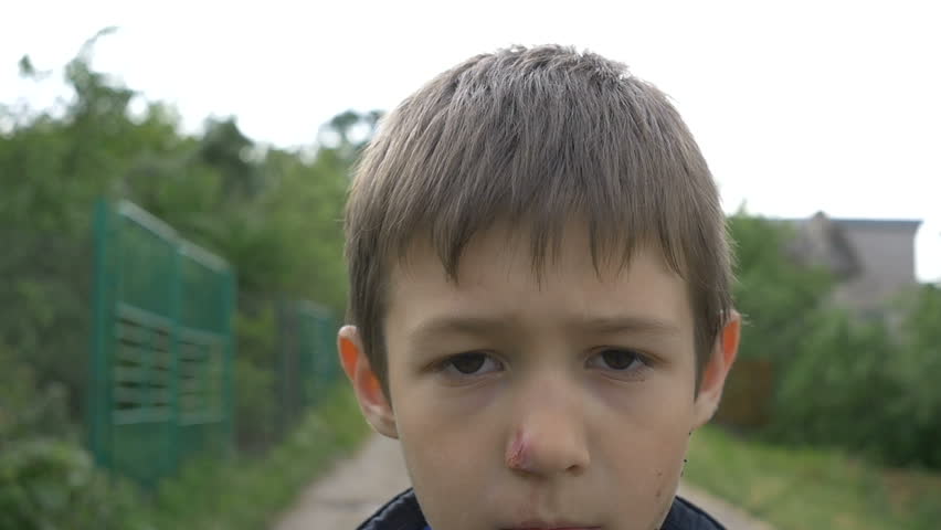 Angry Beaten Pained Boy on the Street closeup, Plans on Revenge Royalty-Free Stock Footage #33094660