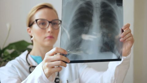 Female doctor examines x-ray of lungs, holding it in hands indoors. Specialist holds transparent image of chest in arms, and carefully researches it. Experienced expert dressed in white medical