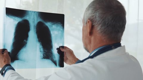 Senior doctor looking at chest x-ray in office.