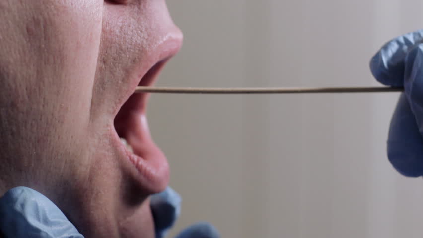 Swabbing mouth for DNA