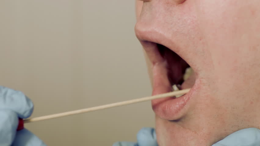 Swabbing man's mouth for DNA