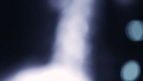 Neck spine MRI Scan or X-Ray video toned. Focus on roentgen and out of focus to blurred creation